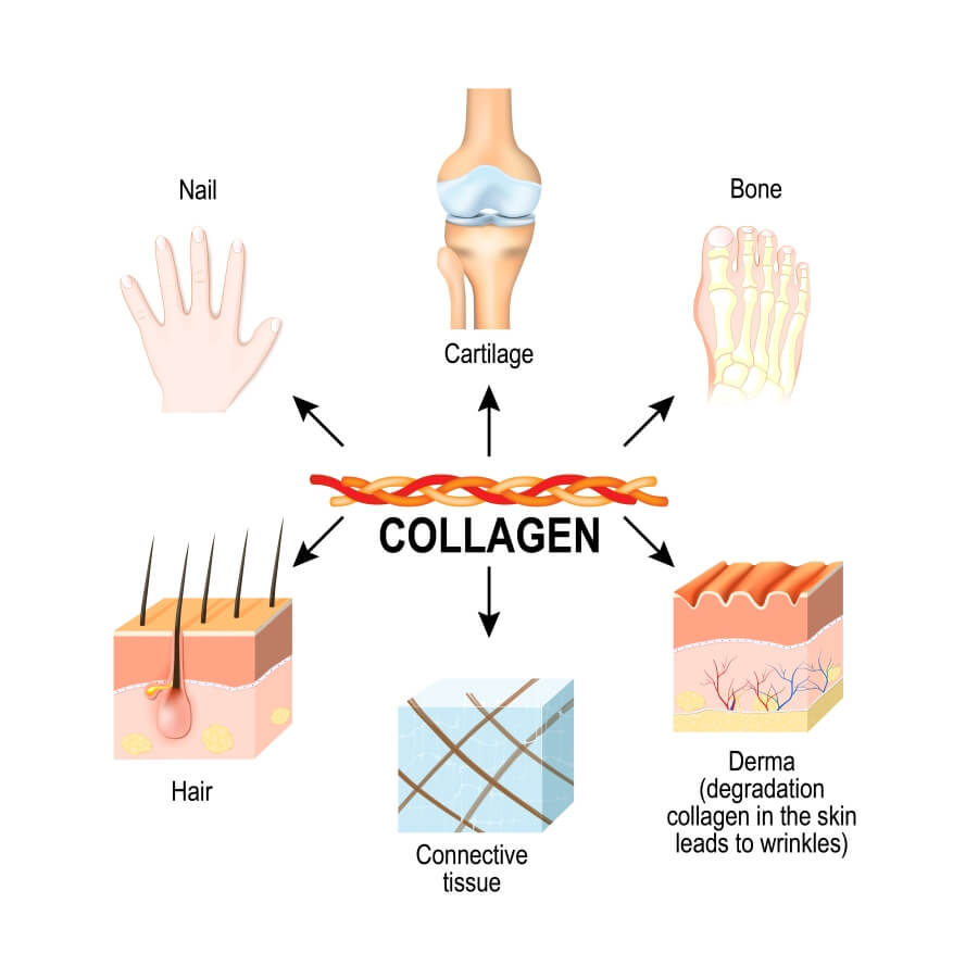 kollagén artrózis kezelésére